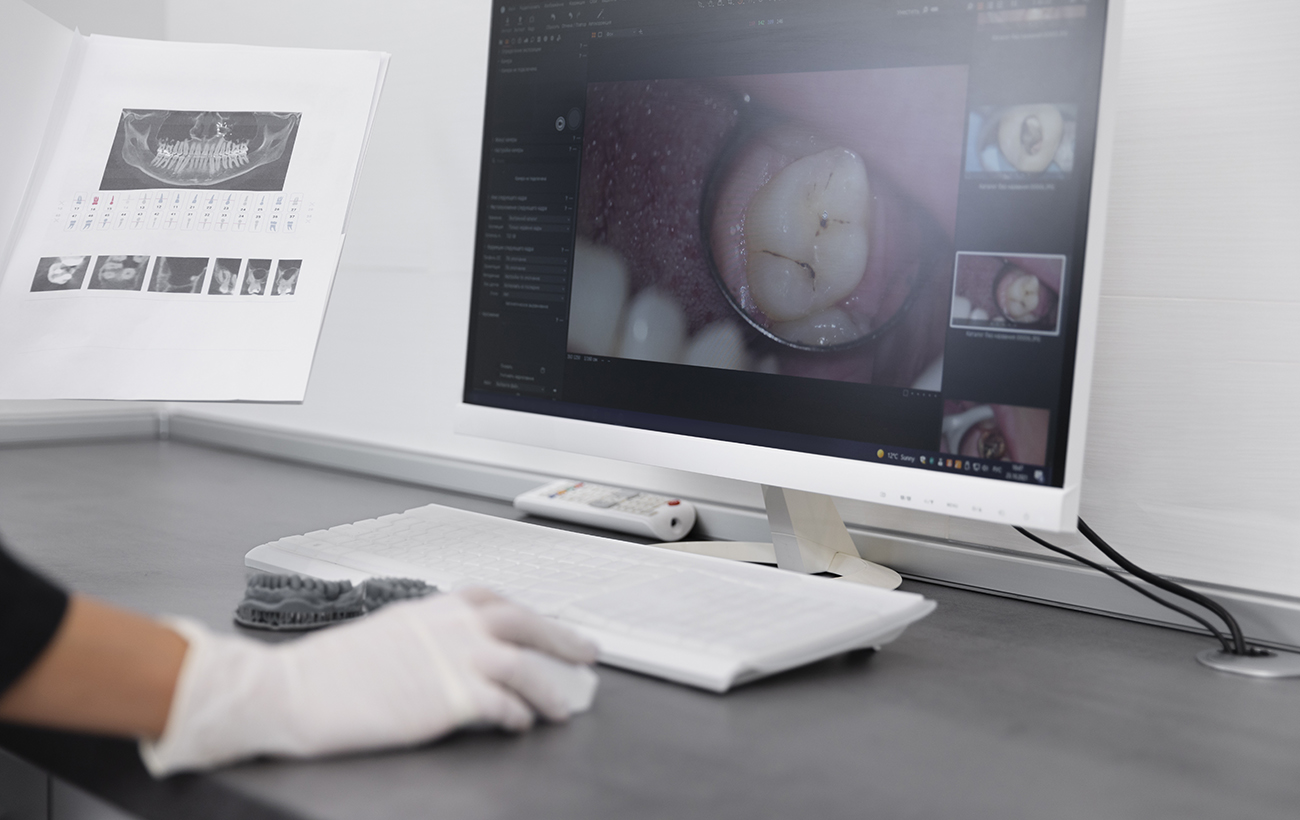 Як зберегти кузов машини взимку: що зробити вже сьогодні